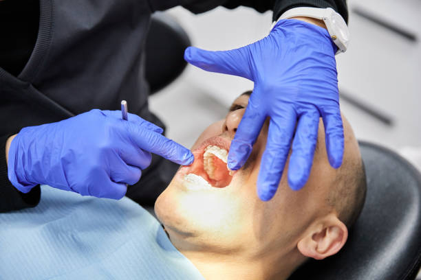 Best Emergency Wisdom Teeth Removal in English, IN